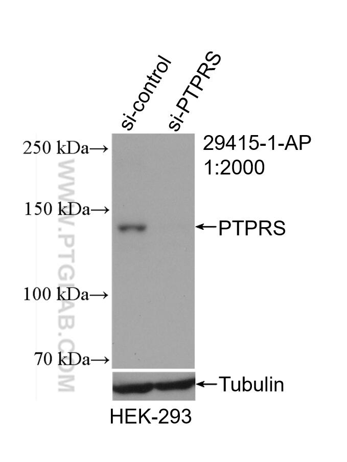 Western Blot (WB) analysis of HEK-293 cells using PTPRS Polyclonal antibody (29415-1-AP)