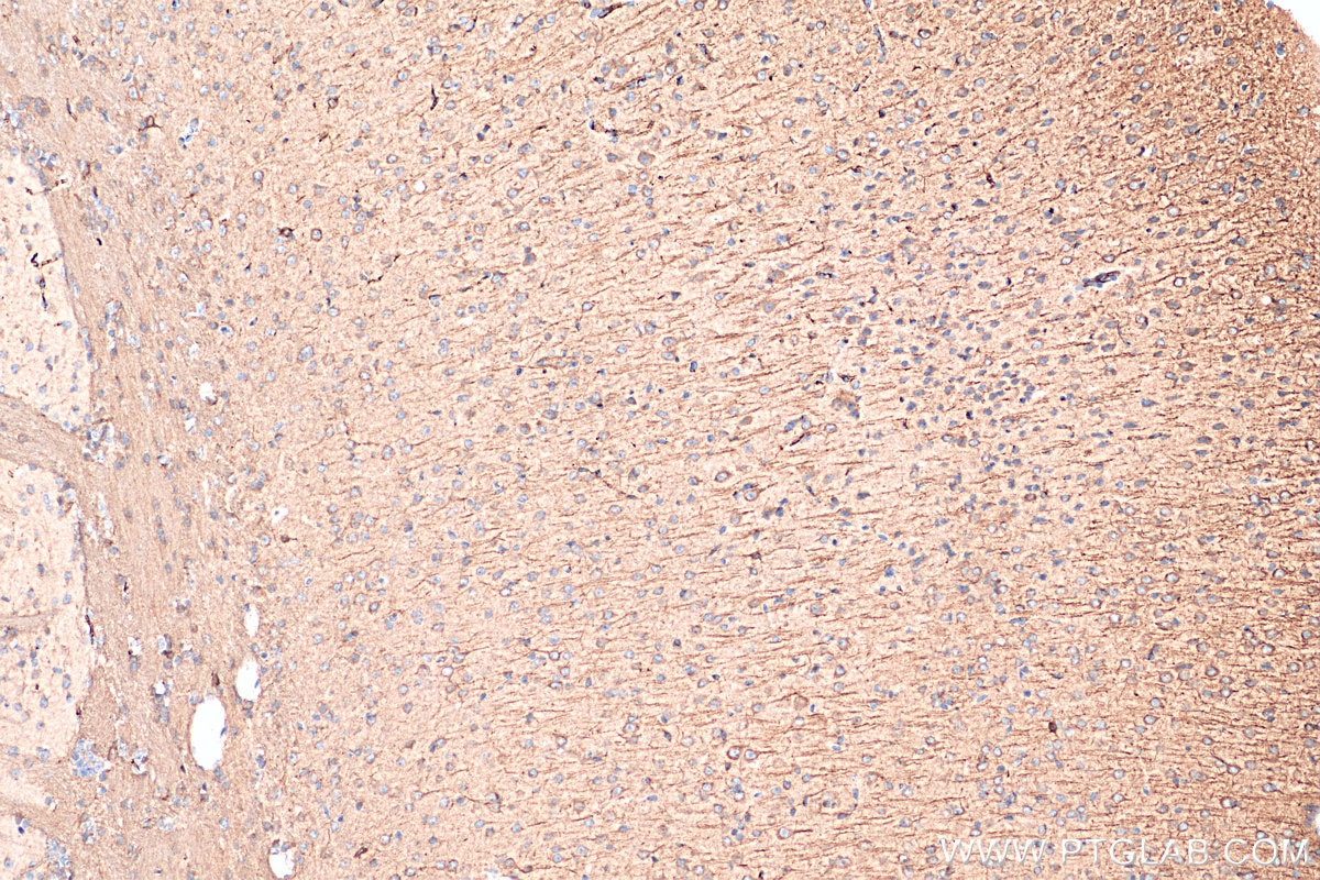 Immunohistochemistry (IHC) staining of mouse brain tissue using PTPRT Polyclonal antibody (25473-1-AP)