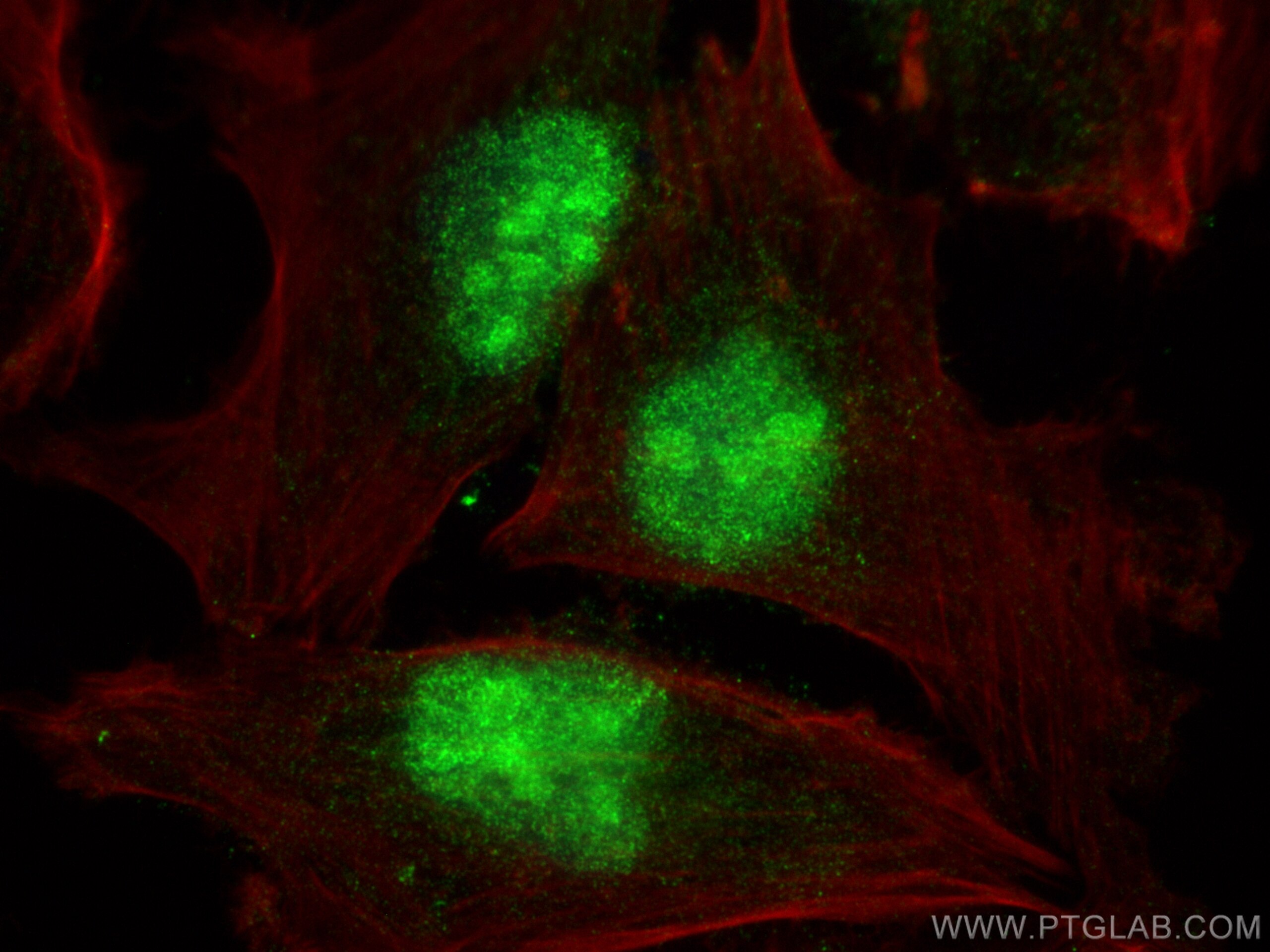 Immunofluorescence (IF) / fluorescent staining of U-251 cells using PTPRU Polyclonal antibody (23786-1-AP)