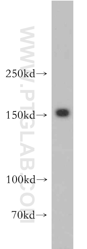 Western Blot (WB) analysis of HepG2 cells using PTPRZ1 Polyclonal antibody (55125-1-AP)