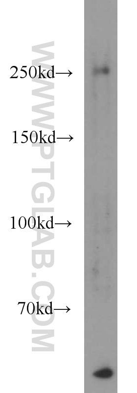 Western Blot (WB) analysis of HeLa cells using PTPRZ1 Polyclonal antibody (55125-1-AP)