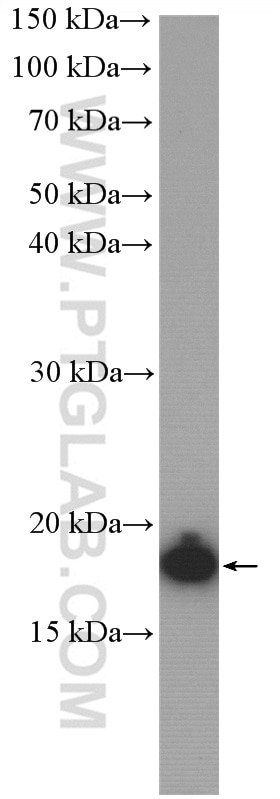 Western Blot (WB) analysis of Jurkat cells using PTRH2 Polyclonal antibody (51006-2-AP)