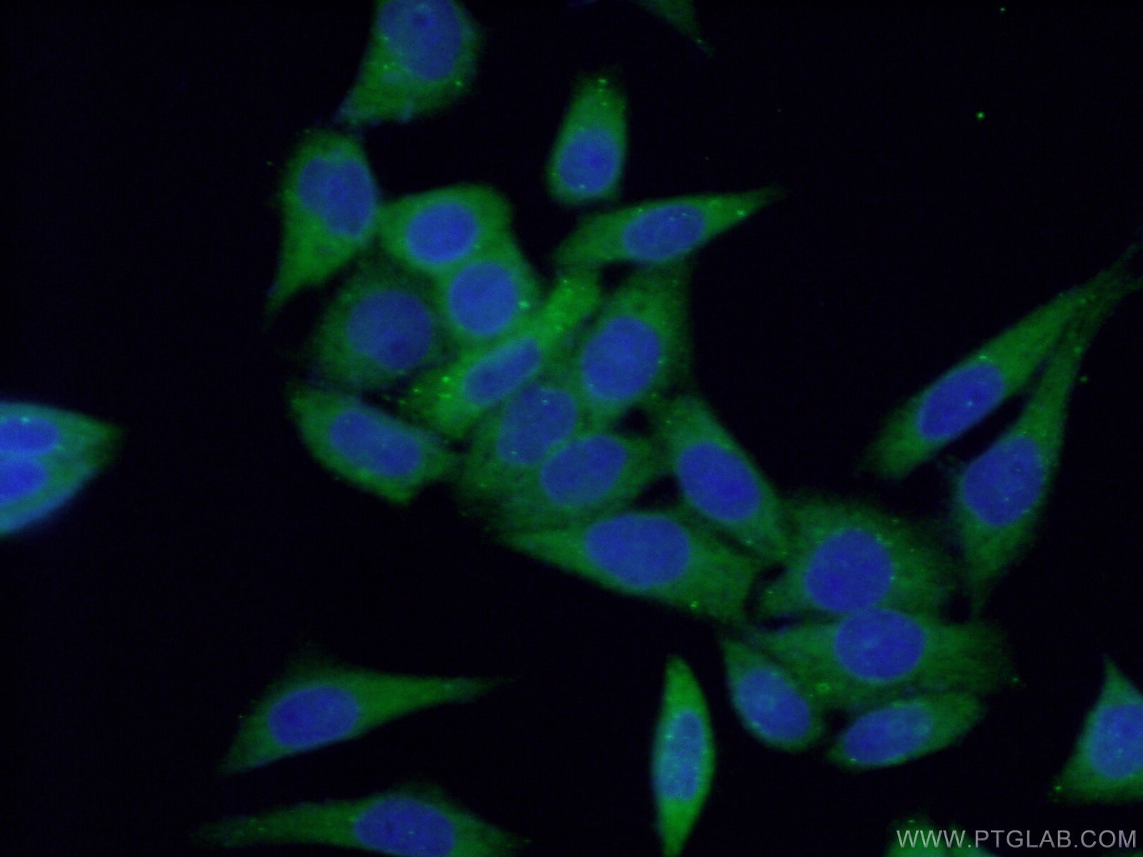 Immunofluorescence (IF) / fluorescent staining of HeLa cells using PTS Polyclonal antibody (12150-1-AP)