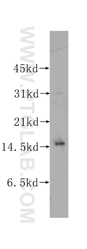 Western Blot (WB) analysis of human brain tissue using PTS Polyclonal antibody (12150-1-AP)