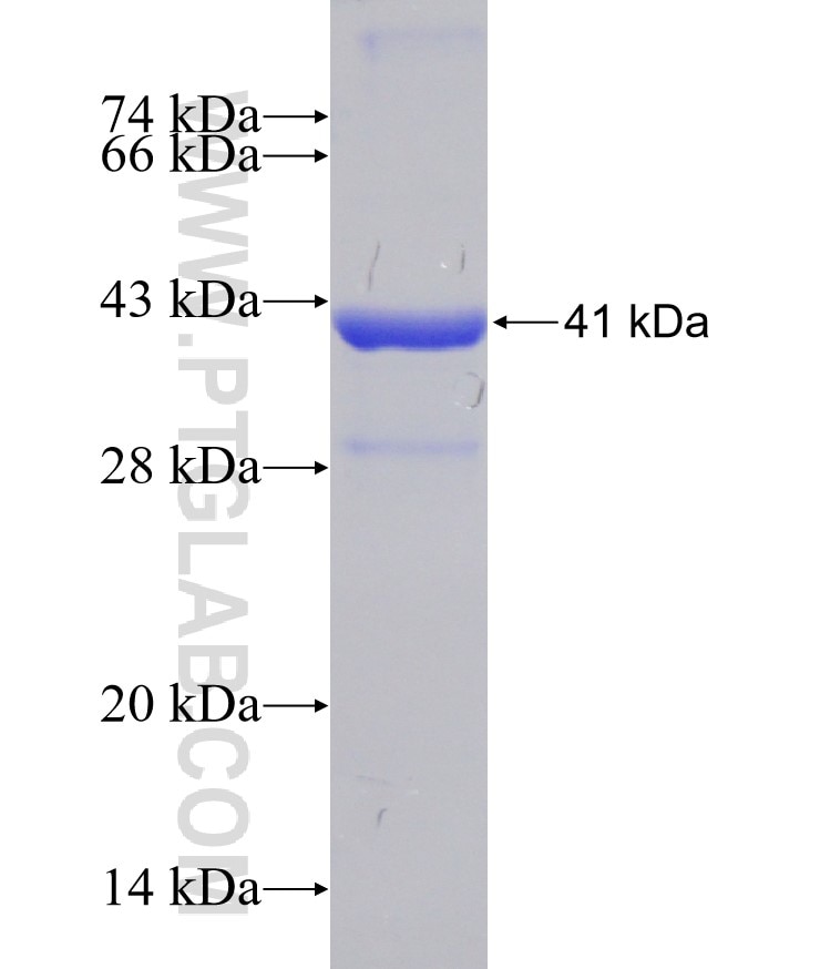 PTS fusion protein Ag2798 SDS-PAGE