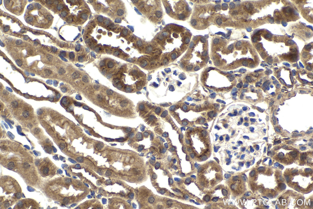Immunohistochemistry (IHC) staining of mouse kidney tissue using PTTG1IP Polyclonal antibody (12575-1-AP)