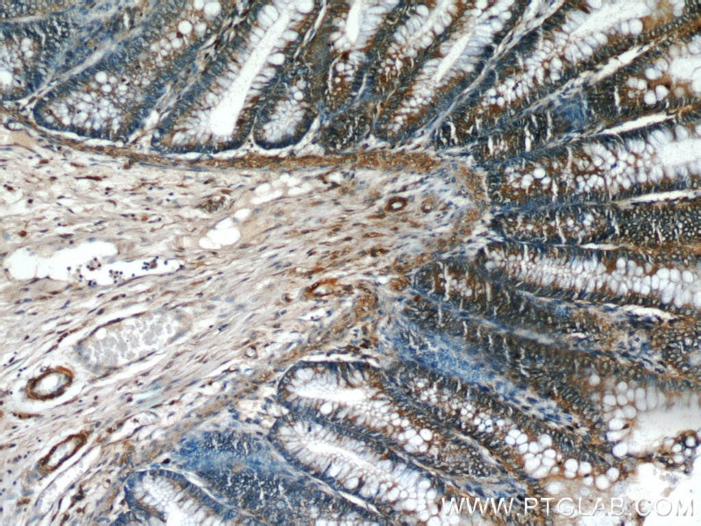 Immunohistochemistry (IHC) staining of human colon tissue using PTTG1IP Polyclonal antibody (12575-1-AP)