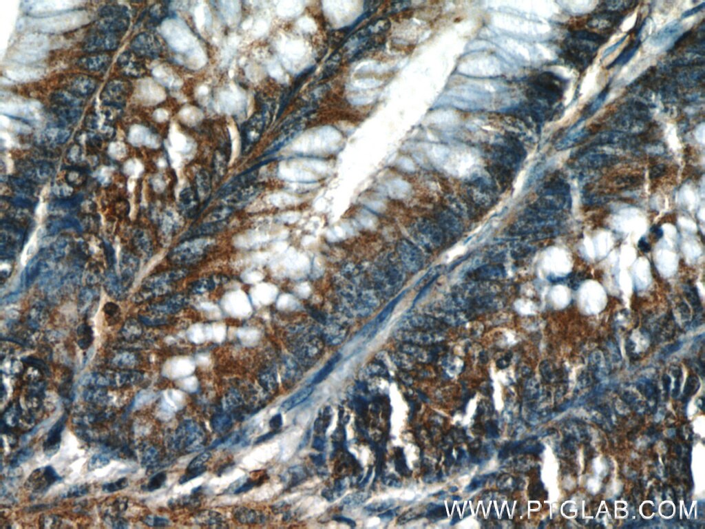 Immunohistochemistry (IHC) staining of human colon tissue using PTTG1IP Polyclonal antibody (12575-1-AP)