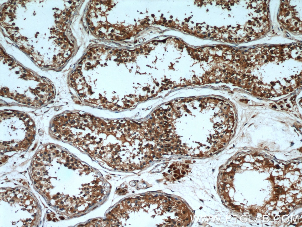 IHC staining of human testis using 12575-1-AP