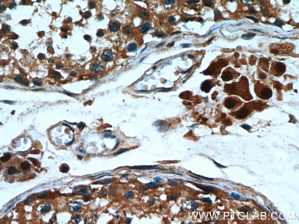 Immunohistochemistry (IHC) staining of human testis tissue using PTTG1IP Polyclonal antibody (12575-1-AP)