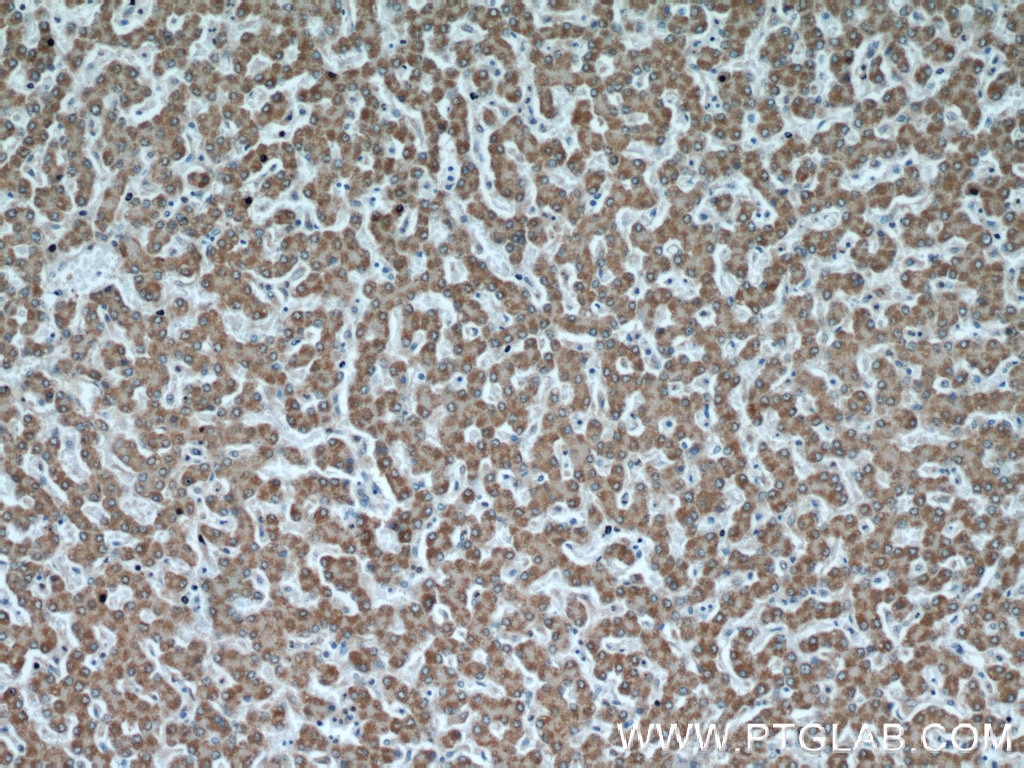 Immunohistochemistry (IHC) staining of human liver tissue using PTTG1IP Polyclonal antibody (12575-1-AP)
