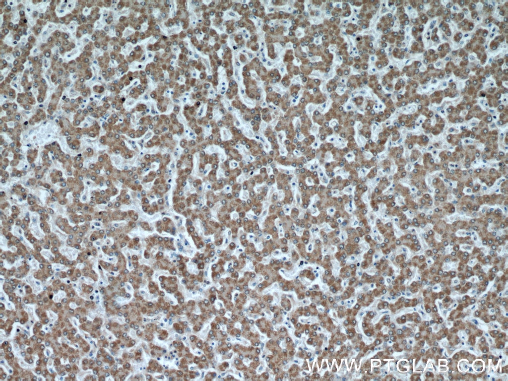 Immunohistochemistry (IHC) staining of human liver tissue using PTTG1IP Polyclonal antibody (12575-1-AP)