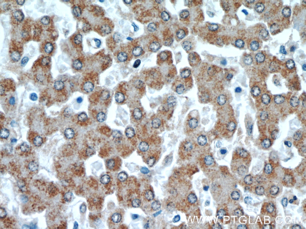 Immunohistochemistry (IHC) staining of human liver tissue using PTTG1IP Polyclonal antibody (12575-1-AP)