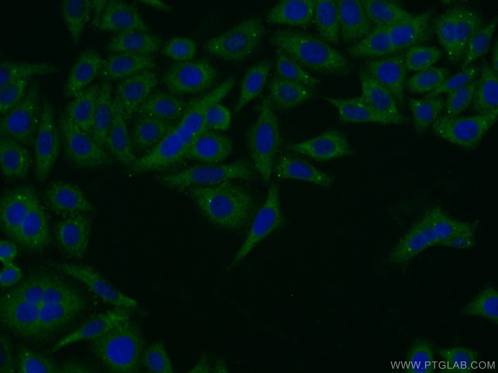 Immunofluorescence (IF) / fluorescent staining of HepG2 cells using Pentraxin 3 Polyclonal antibody (13797-1-AP)