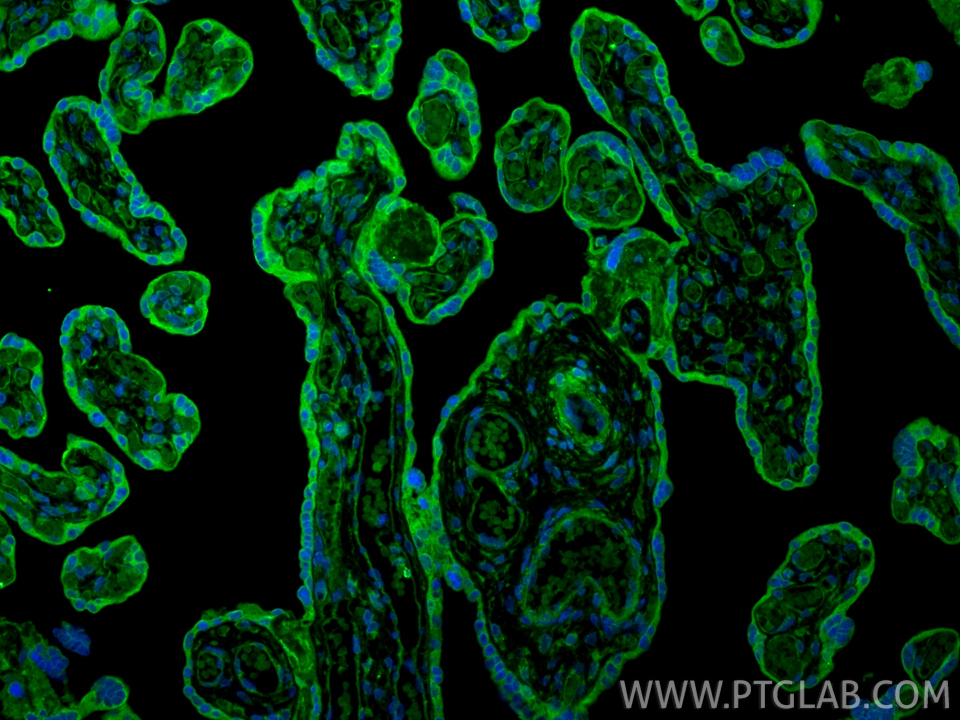 Immunofluorescence (IF) / fluorescent staining of human placenta tissue using Pentraxin 3 Polyclonal antibody (13797-1-AP)
