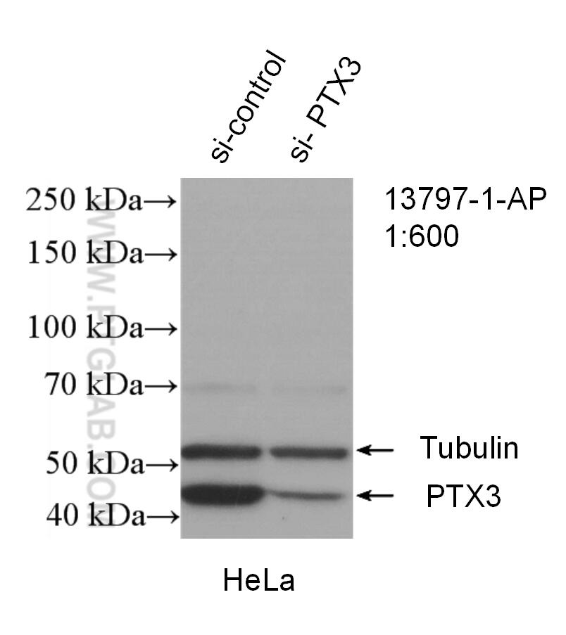 Western Blot (WB) analysis of HeLa cells using Pentraxin 3 Polyclonal antibody (13797-1-AP)