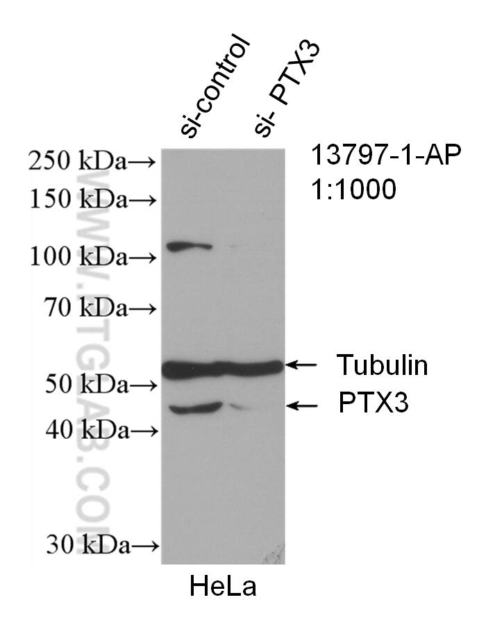 Western Blot (WB) analysis of HeLa cells using Pentraxin 3 Polyclonal antibody (13797-1-AP)