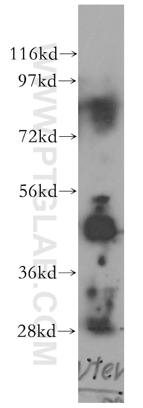 Western Blot (WB) analysis of Jurkat cells using Pentraxin 3 Polyclonal antibody (13797-1-AP)