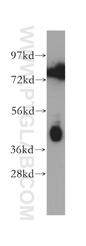 Western Blot (WB) analysis of HepG2 cells using Pentraxin 3 Polyclonal antibody (13797-1-AP)