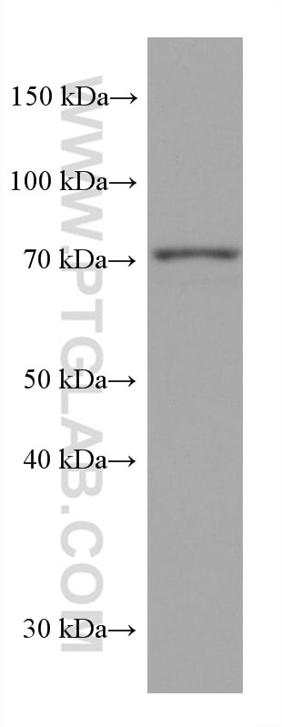 Western Blot (WB) analysis of HSC-T6 cells using PUF-A,KIAA0020 Monoclonal antibody (67941-1-Ig)