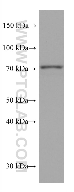 WB analysis of HSC-T6 using 67941-1-Ig