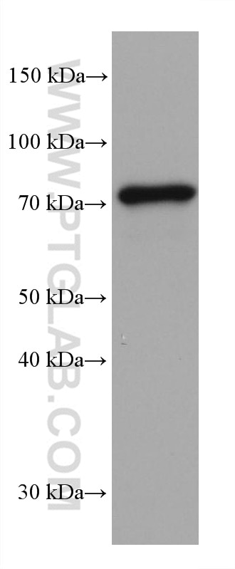 Western Blot (WB) analysis of 4T1 cells using PUF-A,KIAA0020 Monoclonal antibody (67941-1-Ig)