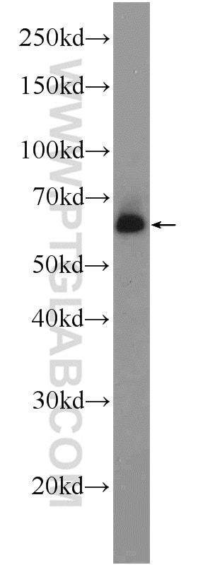 Western Blot (WB) analysis of rat testis tissue using PUF60 Polyclonal antibody (10810-1-AP)