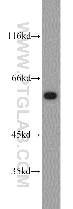 Western Blot (WB) analysis of HepG2 cells using PUF60 Polyclonal antibody (10810-1-AP)