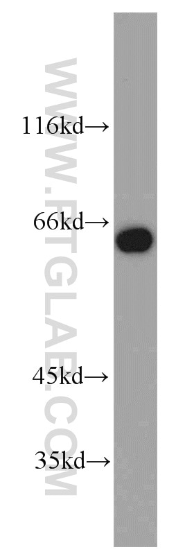 Western Blot (WB) analysis of HeLa cells using PUF60 Polyclonal antibody (10810-1-AP)
