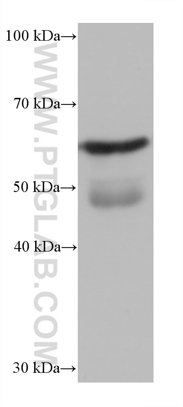 Western Blot (WB) analysis of mouse testis tissue using PUF60 Monoclonal antibody (68533-1-Ig)