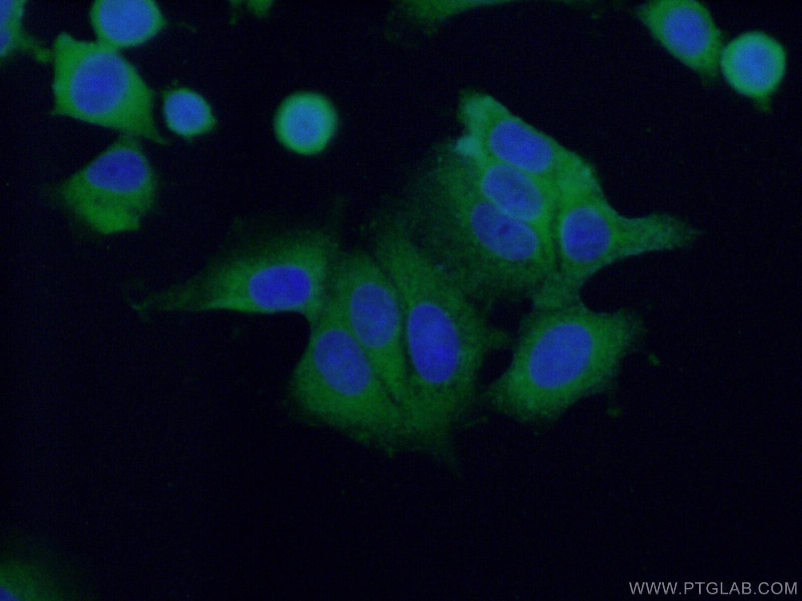 Immunofluorescence (IF) / fluorescent staining of MCF-7 cells using PUM1 Polyclonal antibody (26256-1-AP)