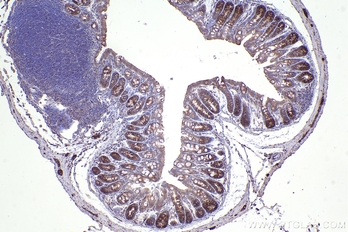 IHC staining of mouse colon using 26256-1-AP Immunohistochemistry (IHC) staining of mouse colon tissue using PUM1 Polyclonal antibody (26256-1-AP)