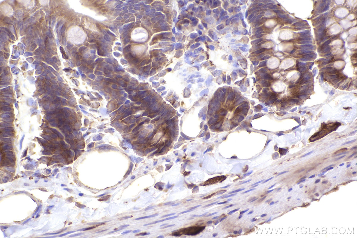 IHC staining of rat small intestine using 26256-1-AP Immunohistochemistry (IHC) staining of rat small intestine tissue using PUM1 Polyclonal antibody (26256-1-AP)