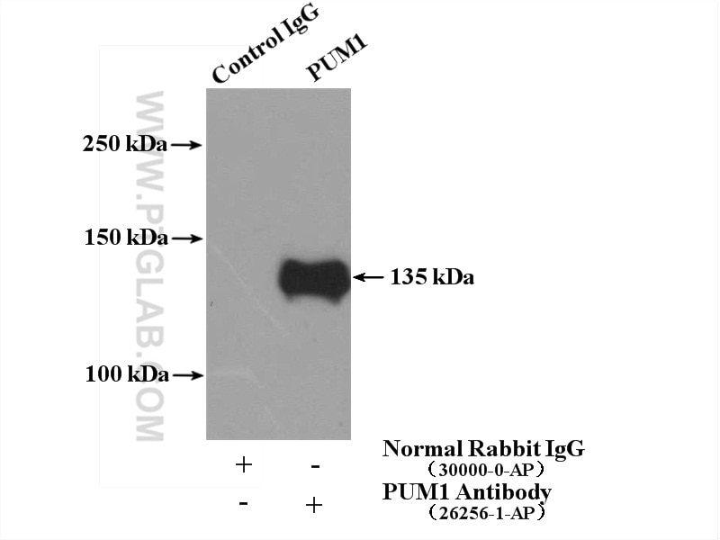 Immunoprecipitation (IP) experiment of MCF-7 cells using PUM1 Polyclonal antibody (26256-1-AP)