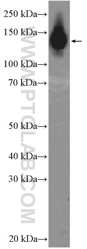 Western Blot (WB) analysis of MCF-7 cells using PUM1 Polyclonal antibody (26256-1-AP)