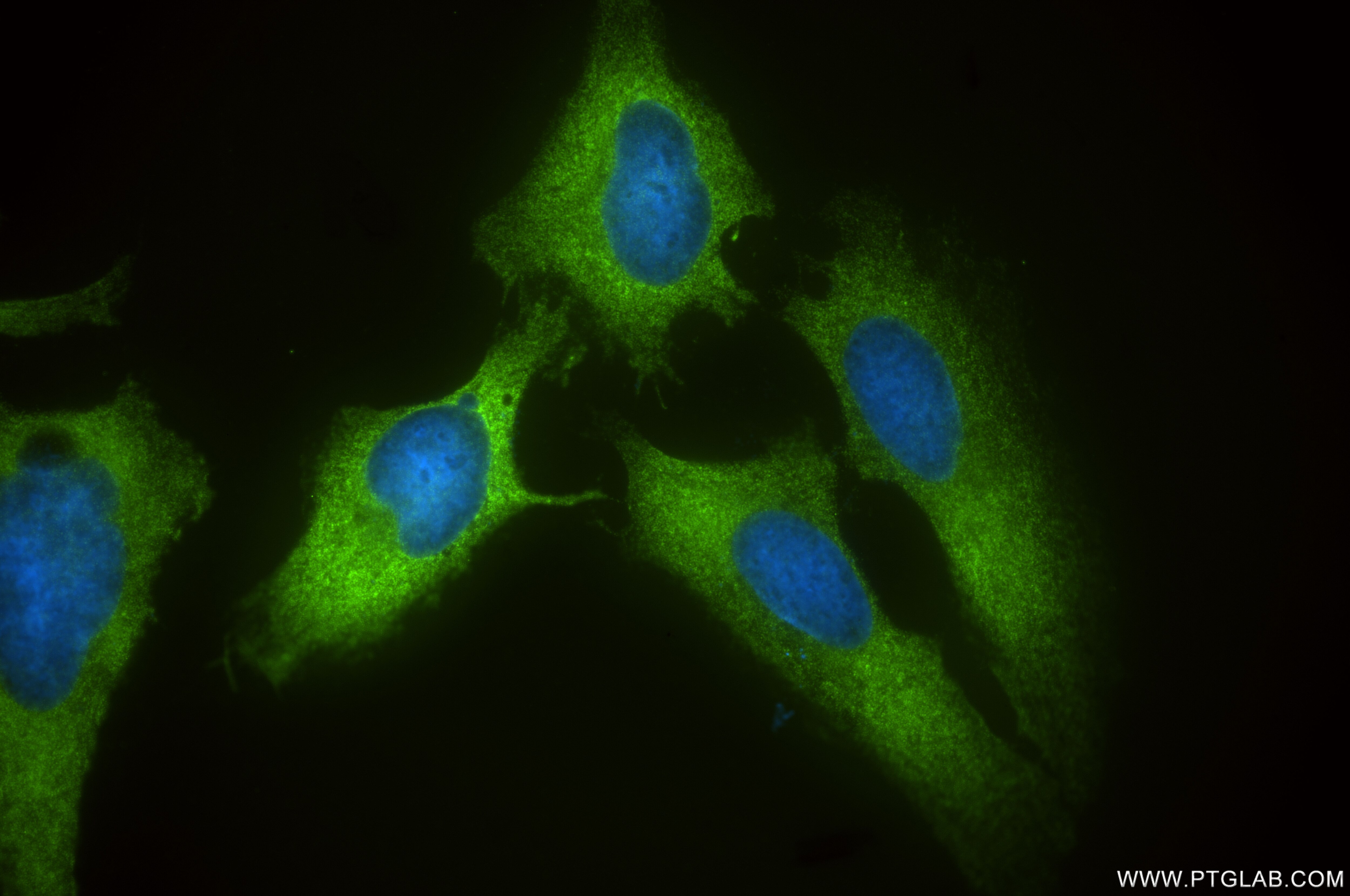 Immunofluorescence (IF) / fluorescent staining of HeLa cells using PUM1 Recombinant antibody (86129-1-RR)