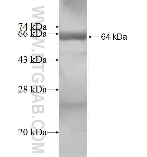 PUM1 fusion protein Ag8790 SDS-PAGE