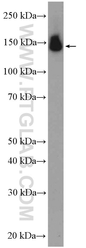 Western Blot (WB) analysis of mouse testis tissue using PUM2 Polyclonal antibody (11586-1-AP)