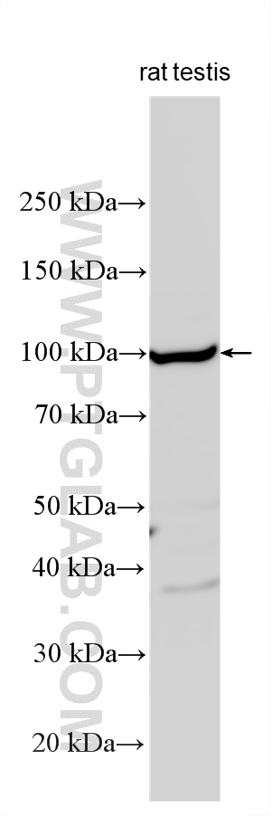 Western Blot (WB) analysis of various lysates using PUM2 Polyclonal antibody (11586-1-AP)