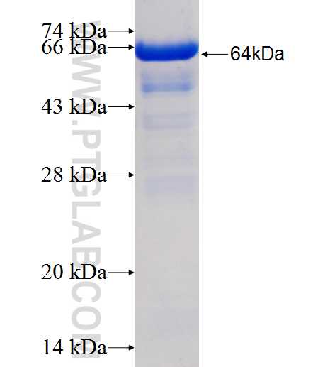 PUM2 fusion protein Ag2179 SDS-PAGE