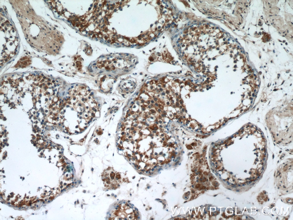 IHC staining of human testis using 55120-1-AP