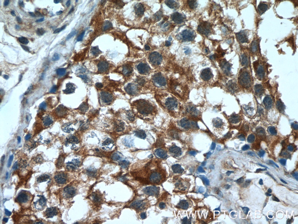 Immunohistochemistry (IHC) staining of human testis tissue using PUMA Polyclonal antibody (55120-1-AP)