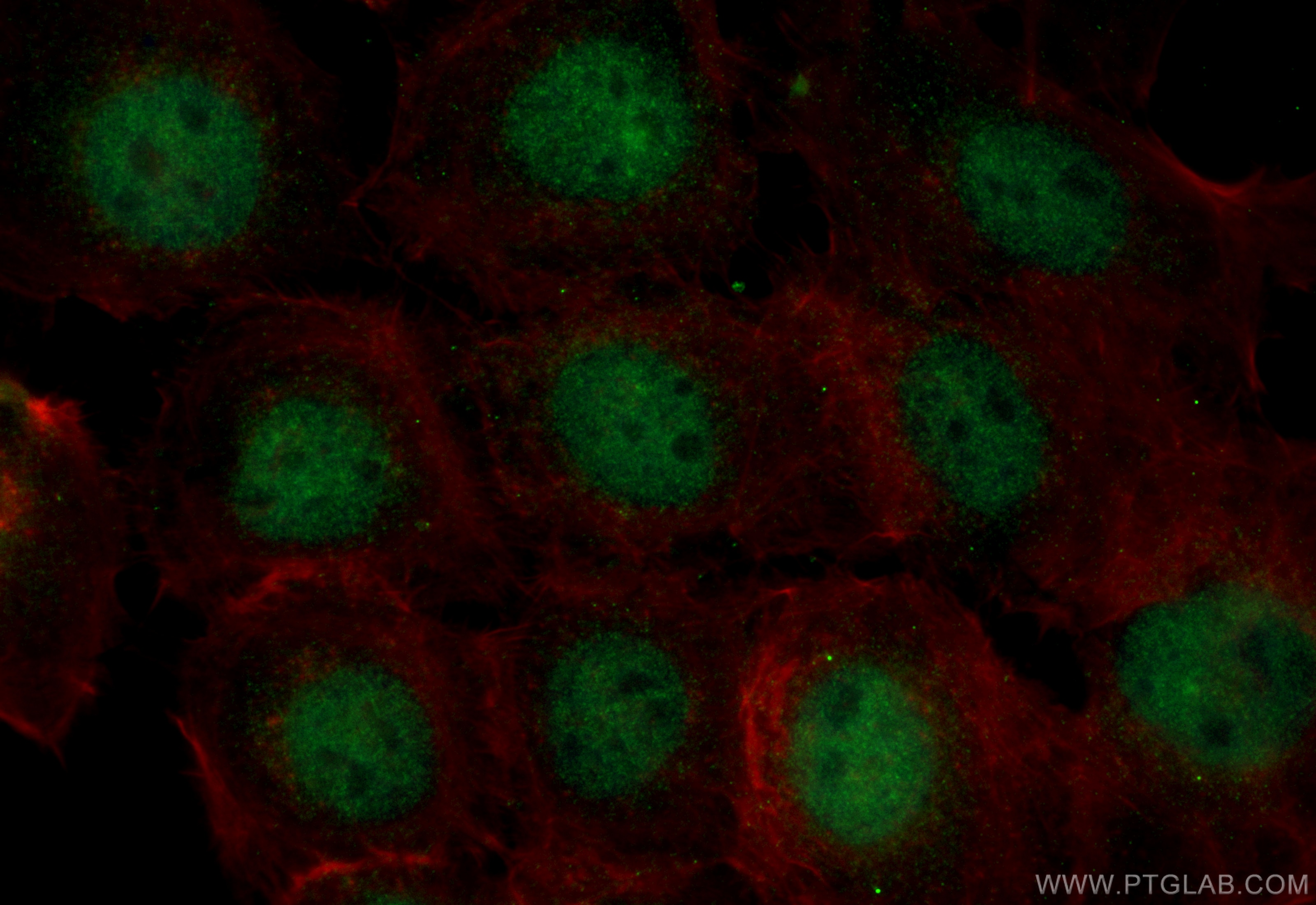 Immunofluorescence (IF) / fluorescent staining of A431 cells using CoraLite® Plus 488-conjugated PURG Recombinant ant (CL488-84399-3)