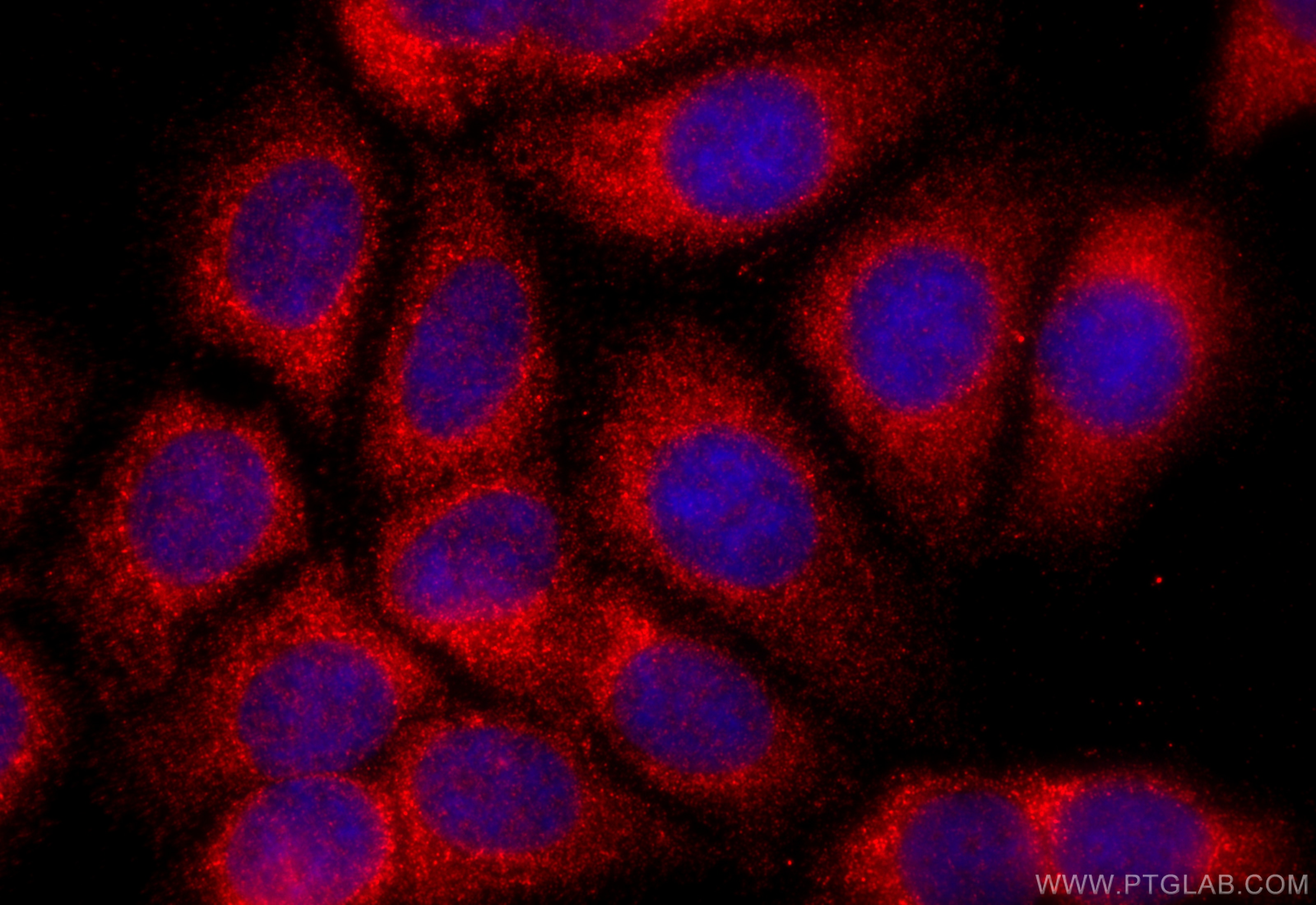 Immunofluorescence (IF) / fluorescent staining of MCF-7 cells using PUS1 Polyclonal antibody (11512-1-AP)