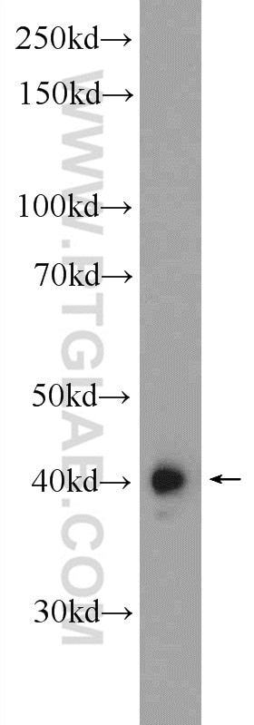 WB analysis of HeLa using 11512-1-AP