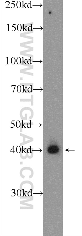 WB analysis of mouse lung using 11512-1-AP