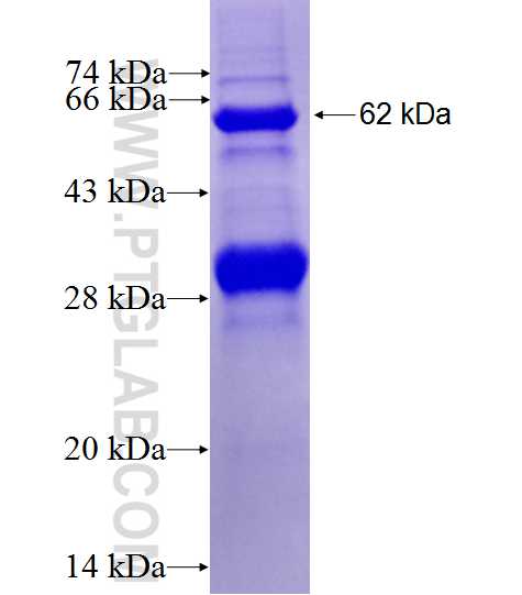 PUS7 fusion protein Ag8484 SDS-PAGE