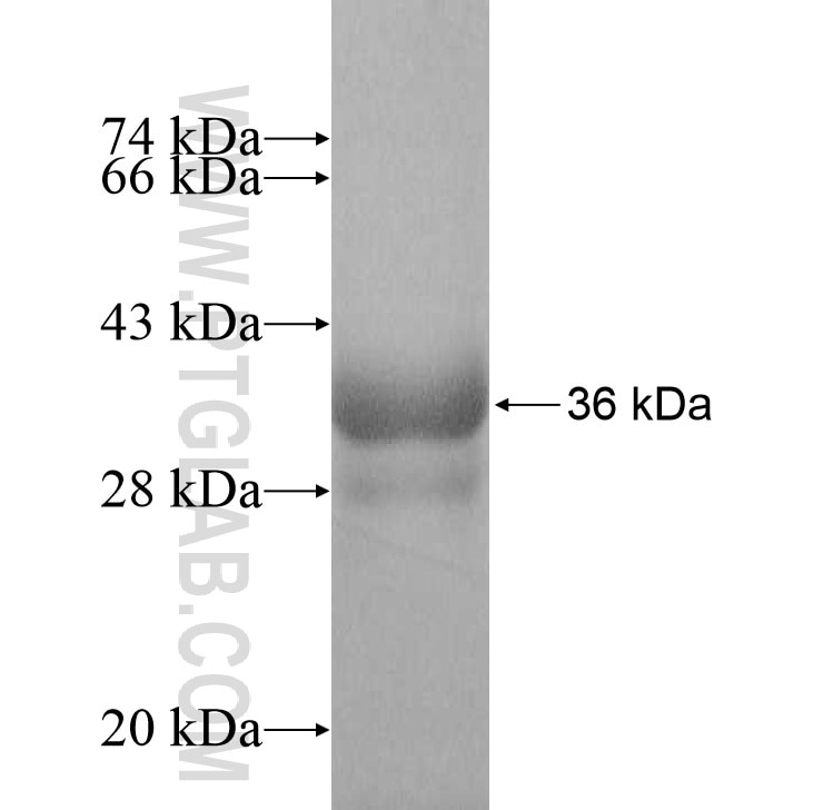 PUS7 fusion protein Ag8799 SDS-PAGE