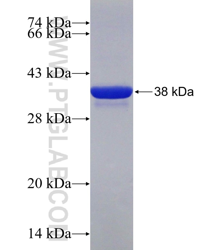 PVALB fusion protein Ag30189 SDS-PAGE