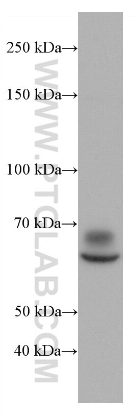 CD155/PVR